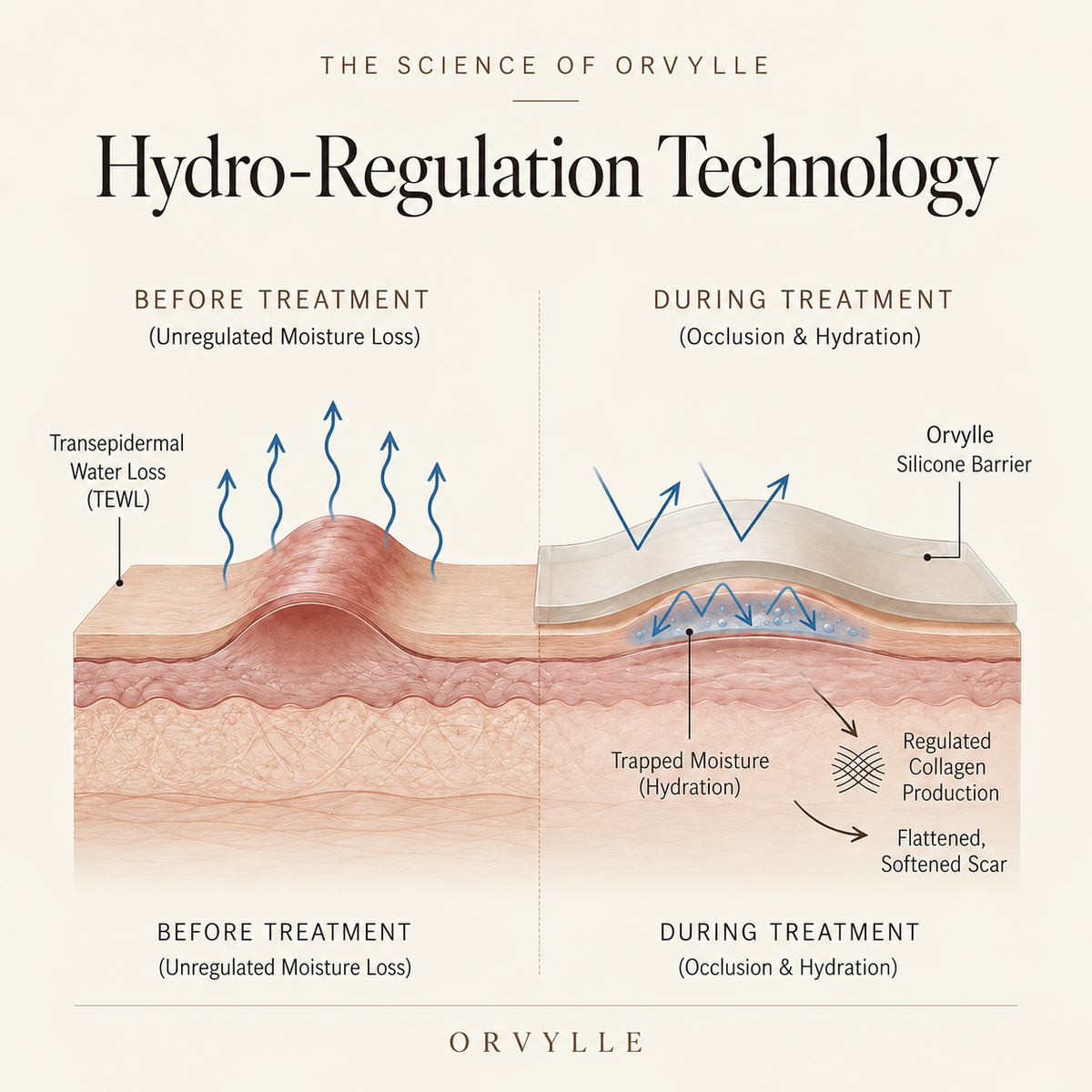 ORVYLLE™ Silicone Recovery Roll