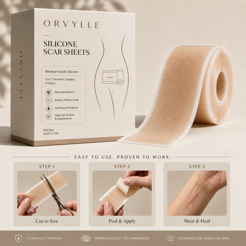ORVYLLE™ Silicone Recovery Roll